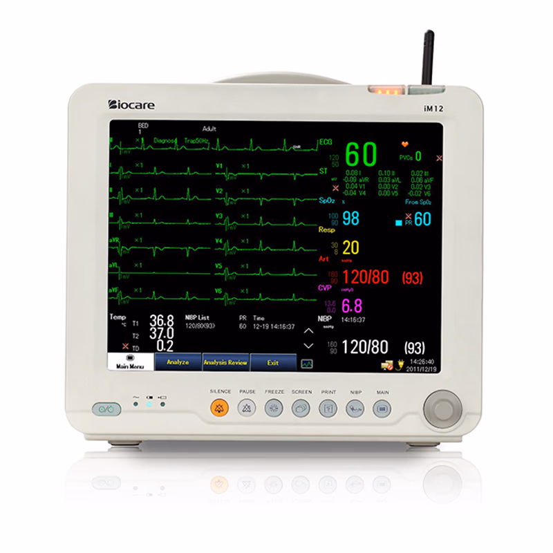 Original Veterinary Multi-parameter Monitor - Biocare iM 12 VET 12.1 inches color TFT screen, Optional full touch-screen, 20 types of arrhythmia and S-T segment analysis, Maximum 480-hour graphic and tabular trends, 1000 NlBP records, 700 alamm events and 2-hour ECG waveform storage and review, Multiple display modes, Drug concentration and tilration table calculation, Support external USB storage, Wire, wireless network connect to central monitoring system, Built in rechargeable battery up to 5 hours of continuous work SKU: iM 12 VET